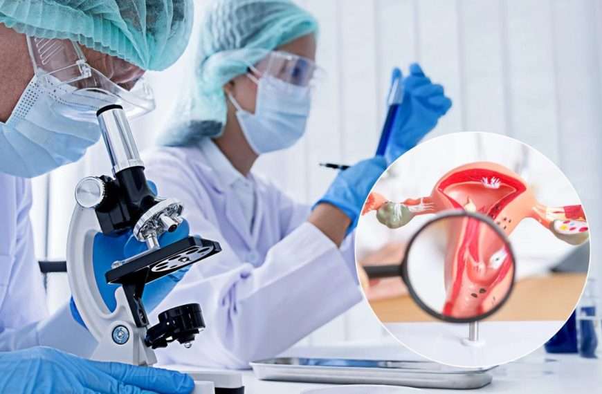 Vacuna contra el cáncer de ovario: Una nueva esperanza para millones de mujeres