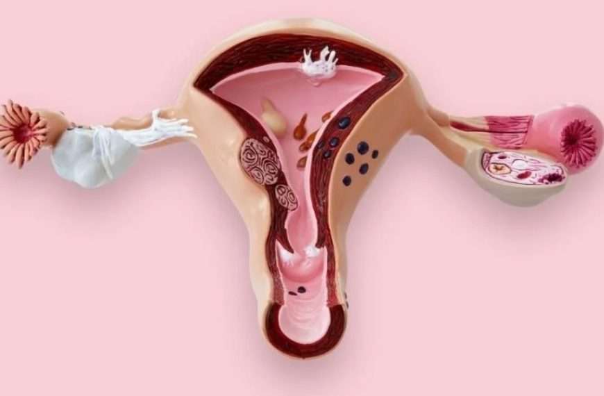 Cáncer de Cuello Uterino un enemigo silencioso en Venezuela