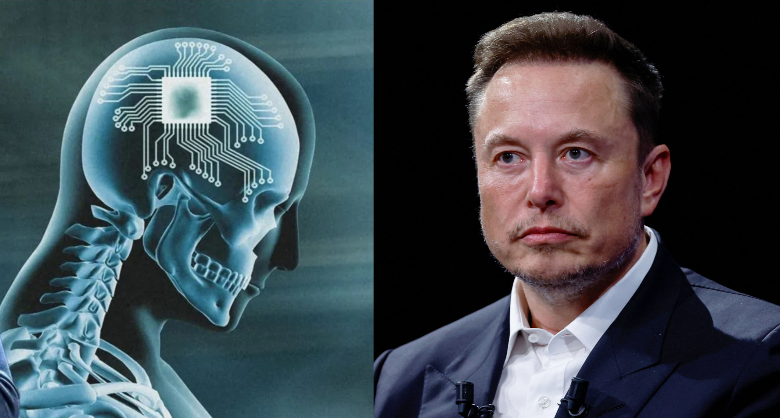 Neuralink